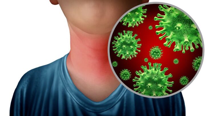 Throat Infection - Causes, Prevention, Treatment