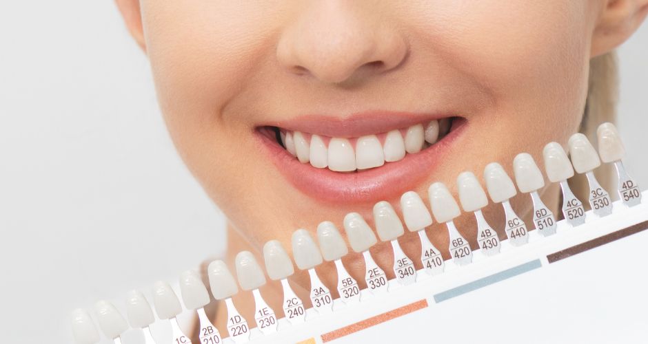 Pros and Cons of Teeth Bonding – 2024